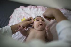 brazilia studiu virus zika microcefalie